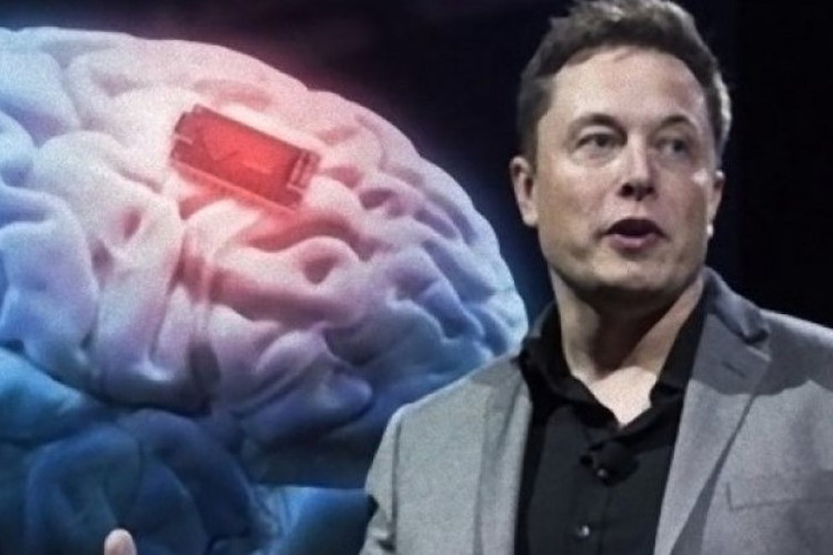 Elon Musk Umumkan Berhasil Tanam Chip di Otak Manusia, Wow Pertama Kali di Dunia!