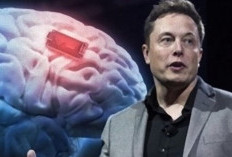 Elon Musk Umumkan Berhasil Tanam Chip di Otak Manusia, Wow Pertama Kali di Dunia!